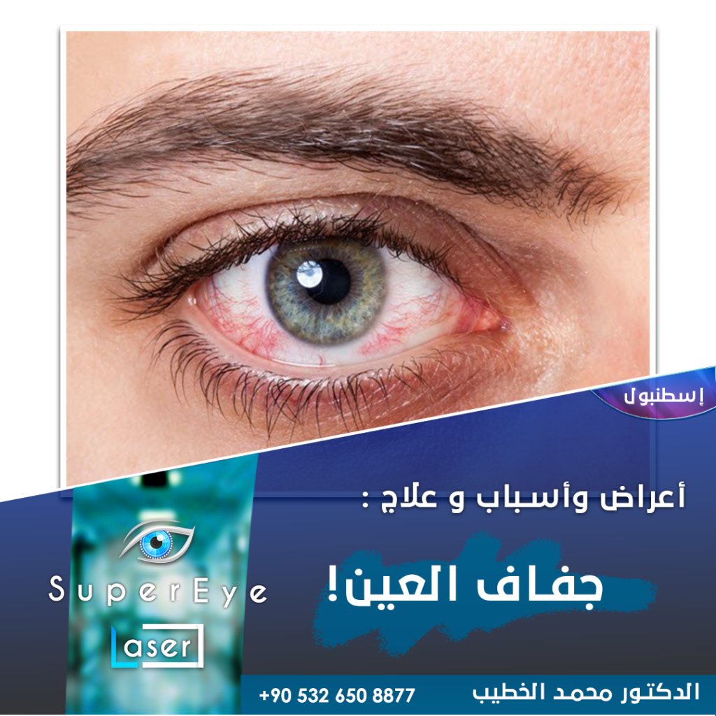 جفاف العين | SuperEyeLaser | فيمتوليزك وعمليات العيون ...